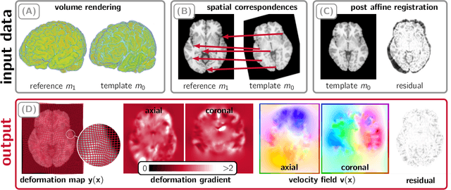 Figure 1 for CLAIRE -- Parallelized Diffeomorphic Image Registration for Large-Scale Biomedical Imaging Applications