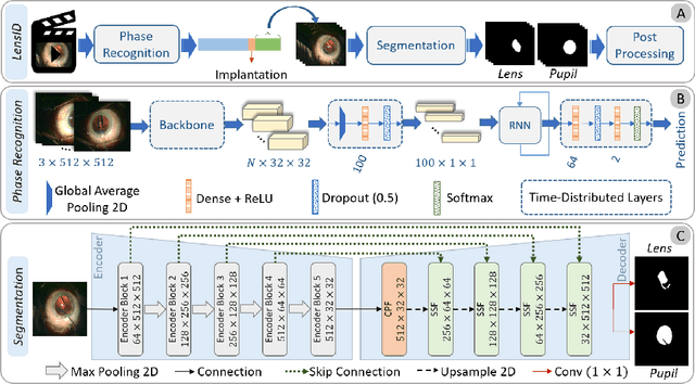 Figure 1 for LensID: A CNN-RNN-Based Framework Towards Lens Irregularity Detection in Cataract Surgery Videos