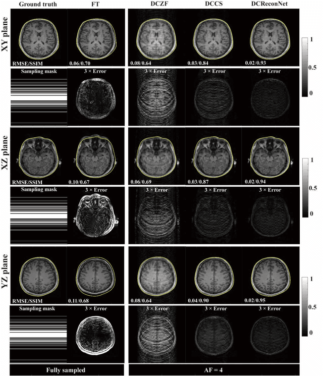 Figure 4 for Distortion-Corrected Image Reconstruction with Deep Learning on an MRI-Linac