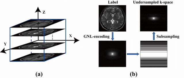 Figure 3 for Distortion-Corrected Image Reconstruction with Deep Learning on an MRI-Linac