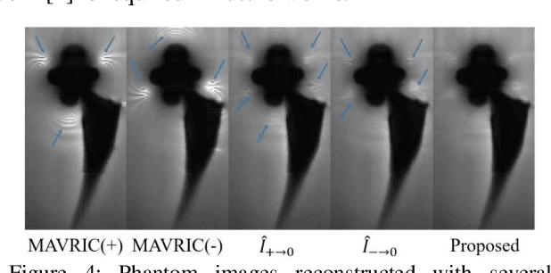 Figure 4 for Attention Guided Metal Artifact Correction in MRI using Deep Neural Networks