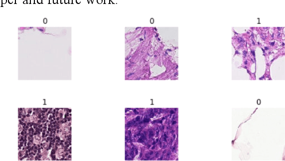 Figure 2 for Metastatic Cancer Image Classification Based On Deep Learning Method