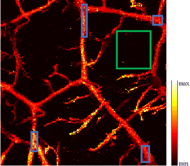 Figure 4 for De-Noising of Photoacoustic Microscopy Images by Deep Learning