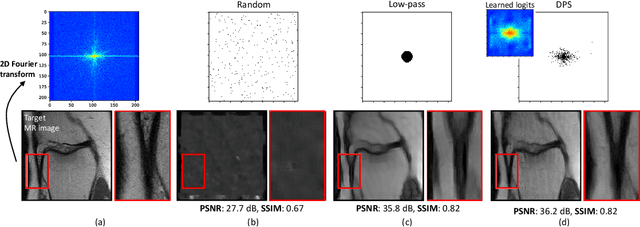 Figure 2 for Learning Sampling and Model-Based Signal Recovery for Compressed Sensing MRI