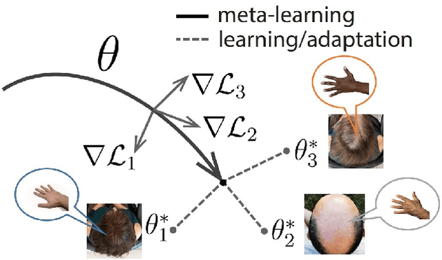 Figure 1 for Model-Agnostic Meta-Learning for EEG Motor Imagery Decoding in Brain-Computer-Interfacing