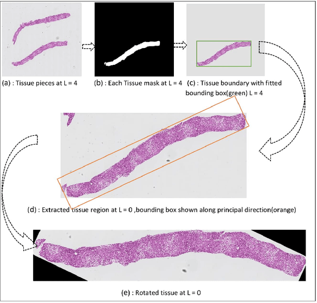 Figure 3 for Segmentation of Overlapped Steatosis in Whole-Slide Liver Histopathology Microscopy Images