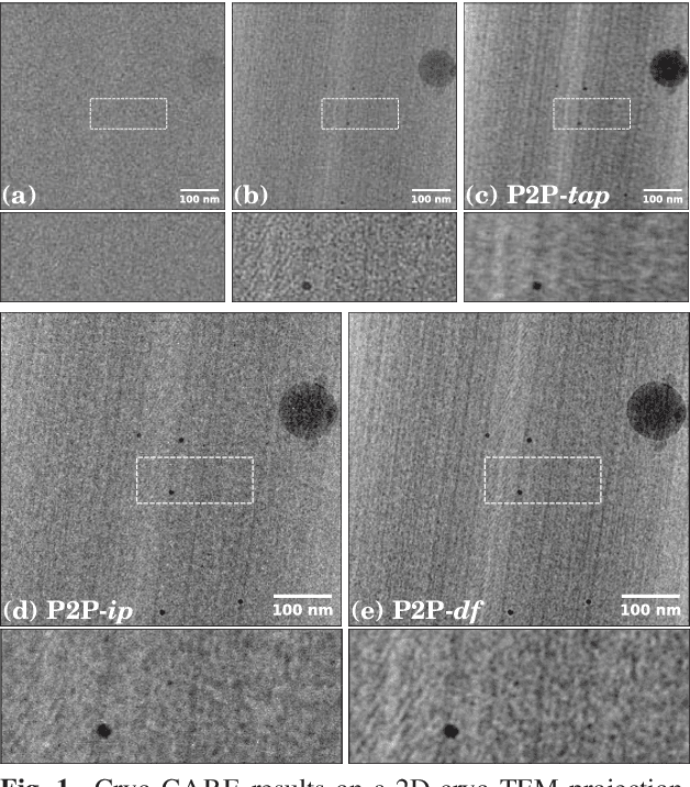 Figure 1 for Cryo-CARE: Content-Aware Image Restoration for Cryo-Transmission Electron Microscopy Data