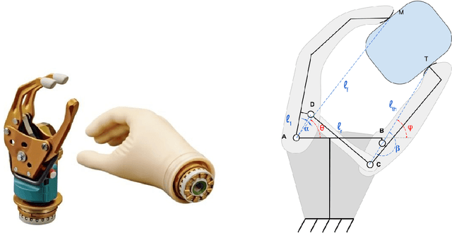 Figure 2 for Cin{é}matique d'une Proth{è}se de Main Myo{é}lectrique Accessible avec Actionneur Unique et R{é}tropulsion Passive du Pouce