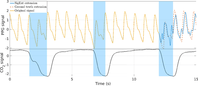 Figure 3 for An Efficient Forecasting Approach to Reduce Boundary Effects in Real-Time Time-Frequency Analysis