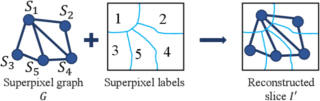 Figure 4 for Graph Neural Network and Superpixel Based Brain Tissue Segmentation (Corrected Version)