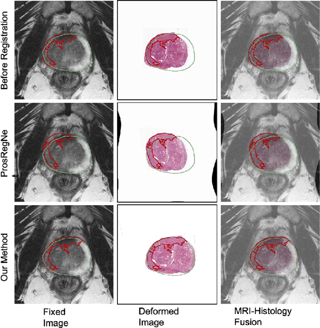 Figure 4 for Weakly Supervised Registration of Prostate MRI and Histopathology Images