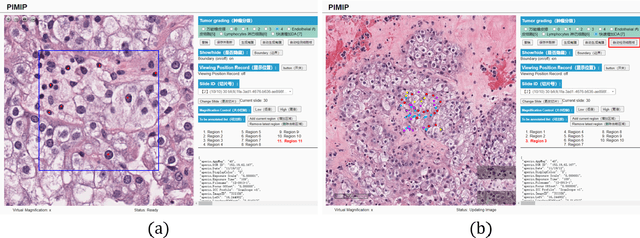 Figure 4 for PIMIP: An Open Source Platform for Pathology Information Management and Integration