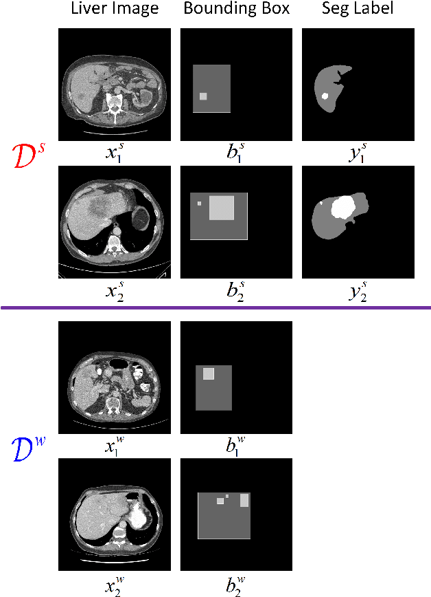 Figure 1 for A Teacher-Student Framework for Semi-supervised Medical Image Segmentation From Mixed Supervision