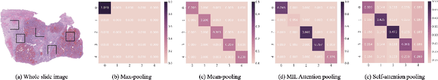 Figure 3 for TransMIL: Transformer based Correlated Multiple Instance Learning for Whole Slide Image Classication