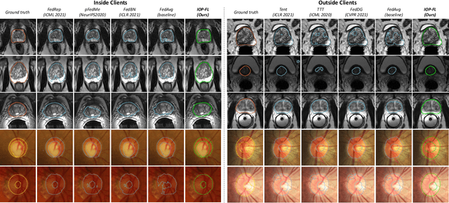 Figure 4 for IOP-FL: Inside-Outside Personalization for Federated Medical Image Segmentation