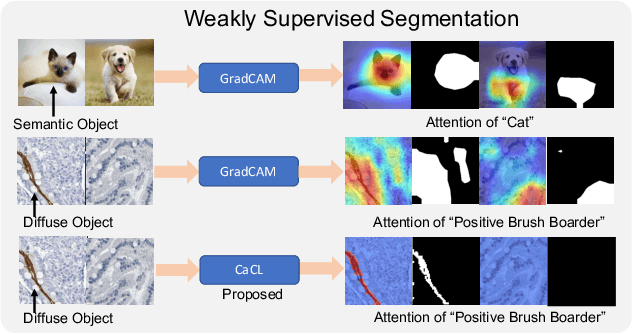 Figure 1 for CaCL: Class-aware Codebook Learning for Weakly Supervised Segmentation on Diffuse Image Patterns