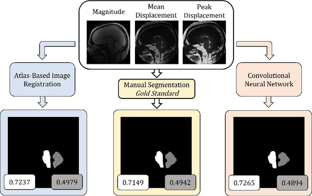Figure 1 for Comparison of atlas-based and neural-network-based semantic segmentation for DENSE MRI images