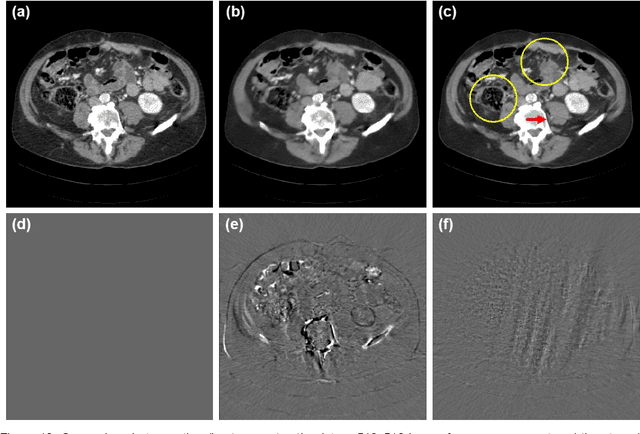 Figure 2 for AI-Enabled Ultra-Low-Dose CT Reconstruction