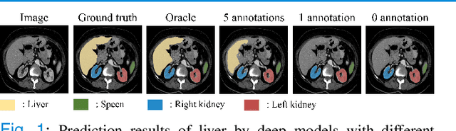 Figure 1 for Domain Adaptation Meets Zero-Shot Learning: An Annotation-Efficient Approach to Multi-Modality Medical Image Segmentation
