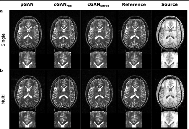 Figure 3 for Image Synthesis in Multi-Contrast MRI with Conditional Generative Adversarial Networks