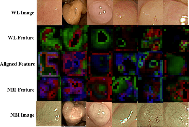 Figure 4 for Colorectal Polyp Classification from White-light Colonoscopy Images via Domain Alignment
