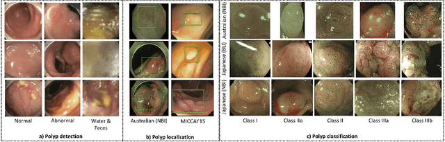 Figure 2 for Detecting, Localising and Classifying Polyps from Colonoscopy Videos using Deep Learning