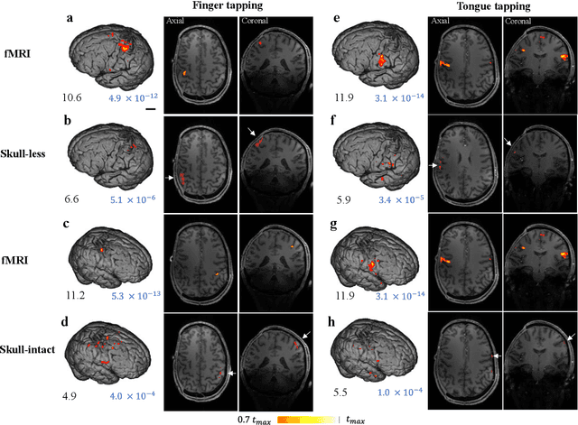 Figure 2 for Transcranial photoacoustic computed tomography of human brain function