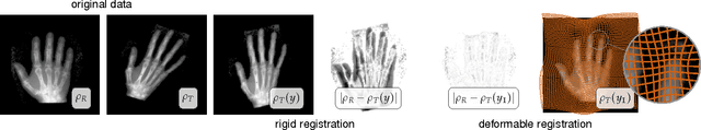 Figure 1 for Distributed-memory large deformation diffeomorphic 3D image registration