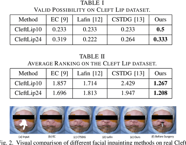 Figure 2 for A Feasibility Study on Image Inpainting for Non-cleft Lip Generation from Patients with Cleft Lip