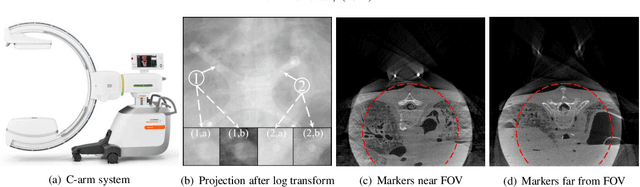 Figure 1 for Fiducial marker recovery and detection from severely truncated data in navigation assisted spine surgery