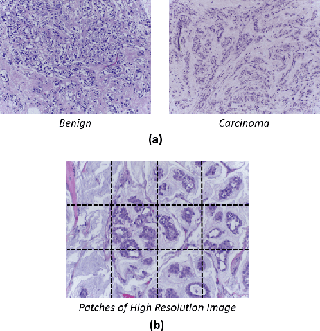 Figure 1 for MCUa: Multi-level Context and Uncertainty aware Dynamic Deep Ensemble for Breast Cancer Histology Image Classification
