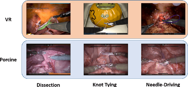 Figure 1 for Surgical Visual Domain Adaptation: Results from the MICCAI 2020 SurgVisDom Challenge