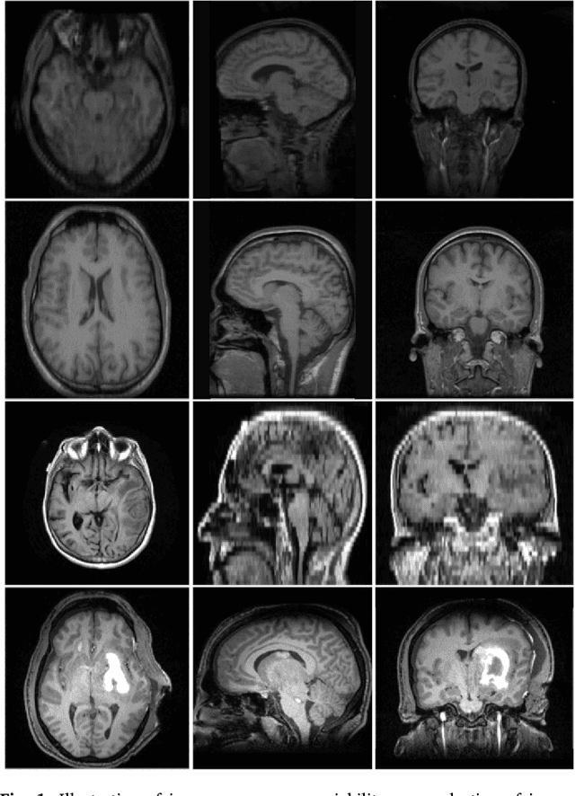Figure 1 for Brain Extraction from Normal and Pathological Images: A Joint PCA/Image-Reconstruction Approach