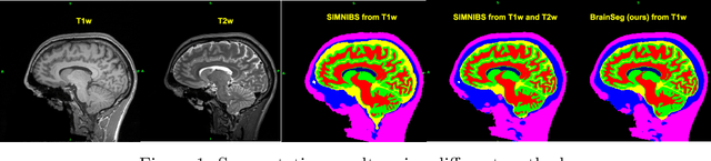 Figure 1 for Learning from imperfect training data using a robust loss function: application to brain image segmentation