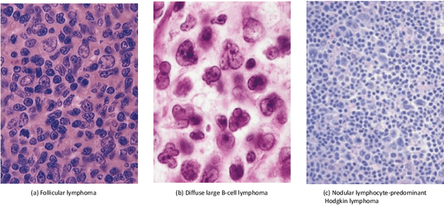 Figure 3 for What Can Machine Vision Do for Lymphatic Histopathology Image Analysis: A Comprehensive Review