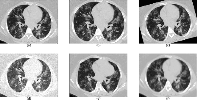 Figure 4 for Quantification of pulmonary involvement in COVID-19 pneumonia by means of a cascade oftwo U-nets: training and assessment on multipledatasets using different annotation criteria