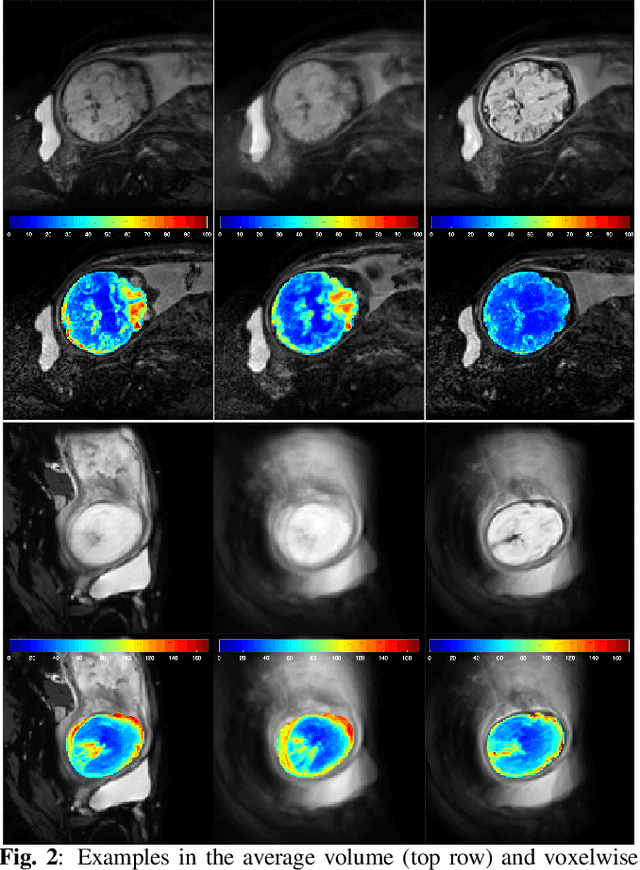 Figure 3 for 4D iterative reconstruction of brain fMRI in the moving fetus