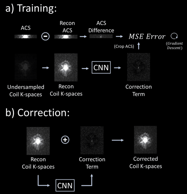 Figure 1 for Scan Specific Artifact Reduction in K-space (SPARK) Neural Networks Synergize with Physics-based Reconstruction to Accelerate MRI