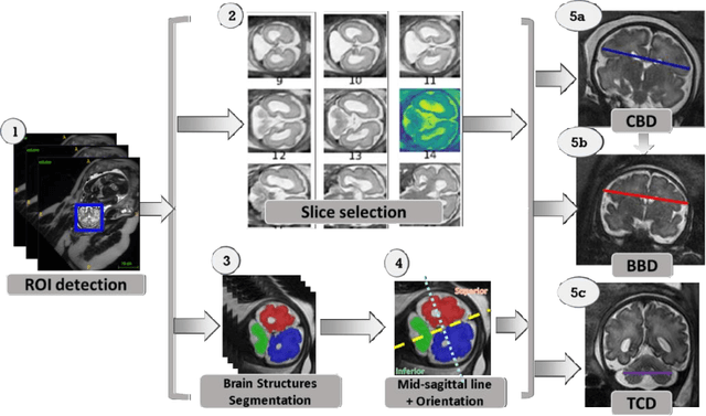 Figure 1 for Automatic linear measurements of the fetal brain on MRI with deep neural networks