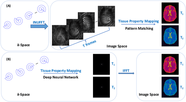 Figure 1 for Real-Time Mapping of Tissue Properties for Magnetic Resonance Fingerprinting