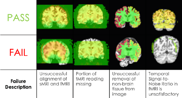 Figure 1 for A Generalizable Method for Automated Quality Control of Functional Neuroimaging Datasets