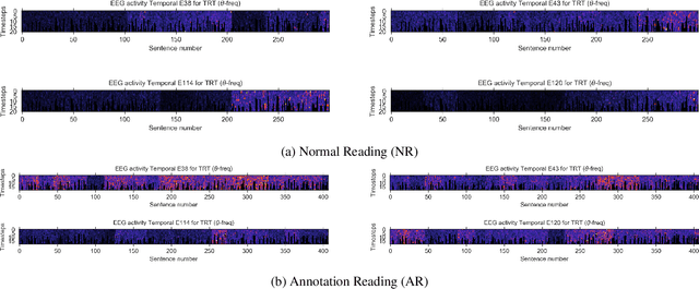 Figure 1 for Human brain activity for machine attention