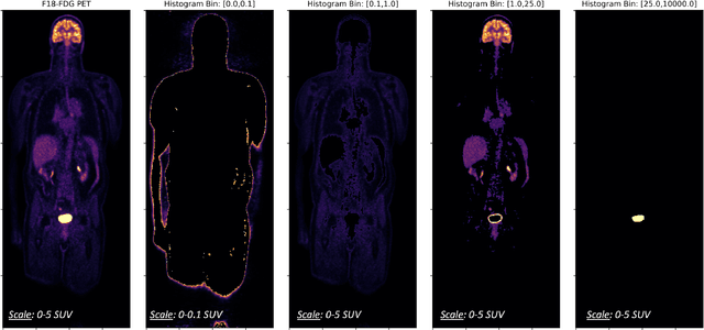 Figure 2 for Synthetic PET via Domain Translation of 3D MRI