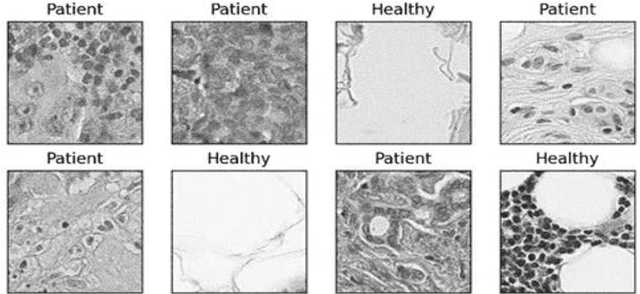 Figure 1 for Transfer learning for cancer diagnosis in histopathological images