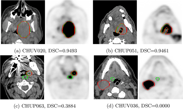 Figure 2 for Overview of the HECKTOR Challenge at MICCAI 2021: Automatic Head and Neck Tumor Segmentation and Outcome Prediction in PET/CT Images