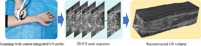Figure 1 for Deep Motion Network for Freehand 3D Ultrasound Reconstruction