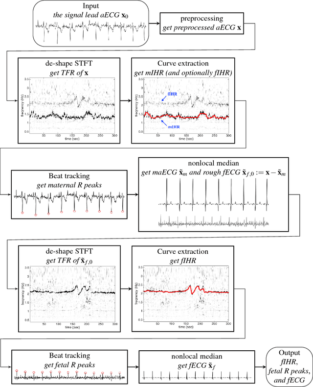 Figure 1 for Extract fetal ECG from single-lead abdominal ECG by de-shape short time Fourier transform and nonlocal median
