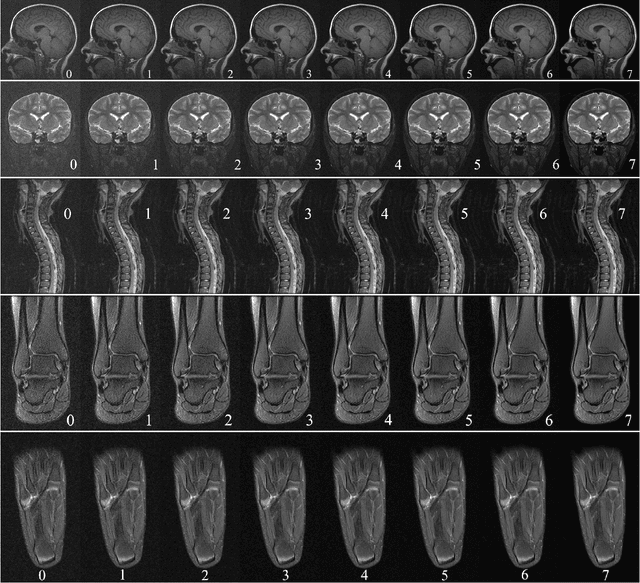 Figure 3 for Artifact- and content-specific quality assessment for MRI with image rulers