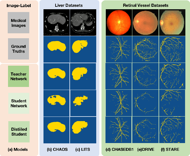Figure 1 for Robust and Efficient Segmentation of Cross-domain Medical Images