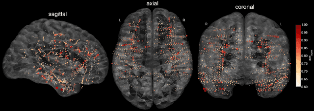 Figure 1 for Intracranial Error Detection via Deep Learning